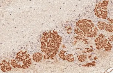 Anti-GABA B Receptor 2 antibody [HL4551] used in IHC (Paraffin sections) (IHC-P). GTX644219