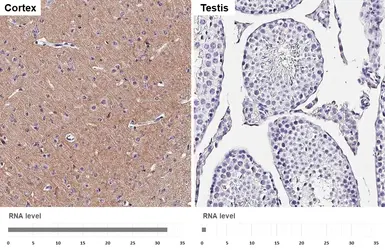 Anti-GABA B Receptor 2 antibody [HL4551] used in IHC (Paraffin sections) (IHC-P). GTX644219