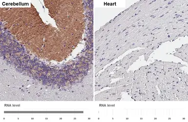 Anti-GABA B Receptor 2 antibody [HL4551] used in IHC (Paraffin sections) (IHC-P). GTX644219