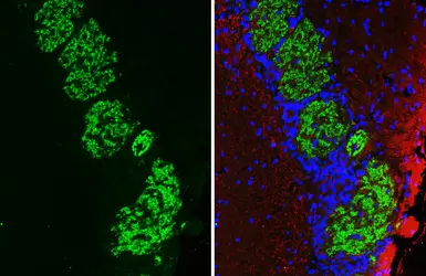 Anti-GABA B Receptor 2 antibody [HL4551] used in IHC (Paraffin sections) (IHC-P). GTX644219