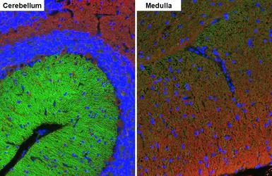 Anti-GABA B Receptor 2 antibody [HL4551] used in IHC (Paraffin sections) (IHC-P). GTX644219
