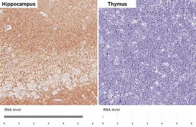 Anti-GABA B Receptor 2 antibody [HL4551] used in IHC (Paraffin sections) (IHC-P). GTX644219