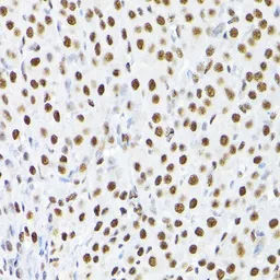 Anti-KAP1 antibody used in Immunocytochemistry/ Immunofluorescence (ICC/IF). GTX64422