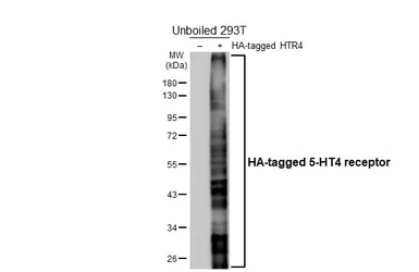 Anti-5-HT4 receptor antibody [HL4554] used in Western Blot (WB). GTX644222