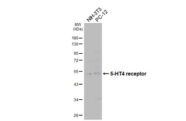Anti-5-HT4 receptor antibody [HL4554] used in Western Blot (WB). GTX644222