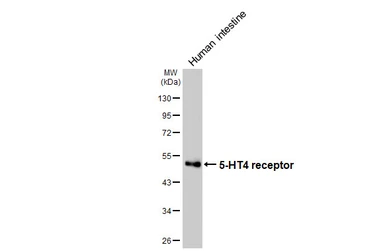 Anti-5-HT4 receptor antibody [HL4554] used in Western Blot (WB). GTX644222