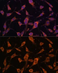 Anti-Fibulin 5 antibody used in Immunocytochemistry/ Immunofluorescence (ICC/IF). GTX64424