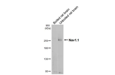 Anti-Nav1.1 antibody [GT230] used in Western Blot (WB). GTX644240