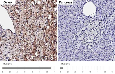Anti-OLFML3 antibody [HL4567] used in IHC (Paraffin sections) (IHC-P). GTX644243