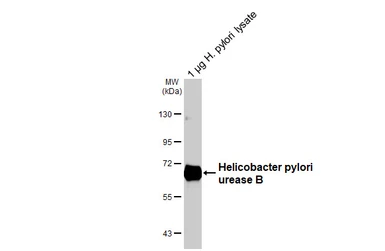 Anti-Helicobacter pylori urease B antibody [HL4569] used in Western Blot (WB). GTX644245
