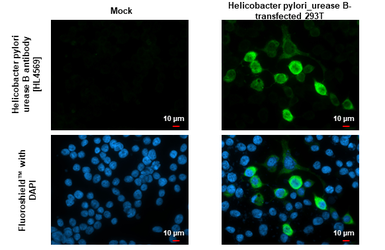 Anti-Helicobacter pylori urease B antibody [HL4569] used in Immunocytochemistry/ Immunofluorescence (ICC/IF). GTX644245