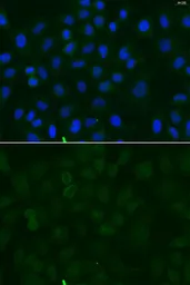 Anti-Sodium/Potassium ATPase alpha 1 antibody used in Immunocytochemistry/ Immunofluorescence (ICC/IF). GTX64425