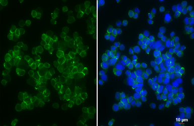 Anti-FPRL1 antibody [HL4589] used in Immunocytochemistry/ Immunofluorescence (ICC/IF). GTX644265