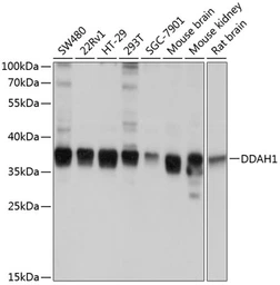 Anti-DDAH1 antibody used in Western Blot (WB). GTX64427