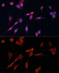 Anti-DDAH1 antibody used in Immunocytochemistry/ Immunofluorescence (ICC/IF). GTX64427