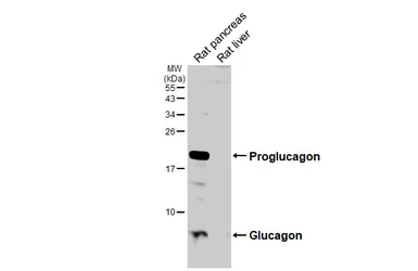 Anti-Glucagon antibody [HL4596] used in Western Blot (WB). GTX644272