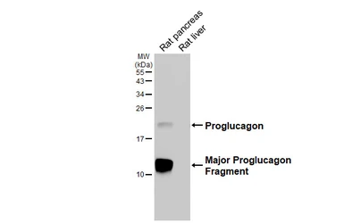 Anti-GLP1 antibody [HL4597] used in Western Blot (WB). GTX644273