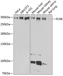 Anti-Filamin B antibody used in Western Blot (WB). GTX64428