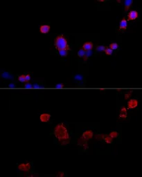 Anti-Filamin B antibody used in Immunocytochemistry/ Immunofluorescence (ICC/IF). GTX64428