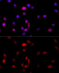Anti-Filamin B antibody used in Immunocytochemistry/ Immunofluorescence (ICC/IF). GTX64428