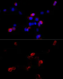 Anti-Filamin B antibody used in Immunocytochemistry/ Immunofluorescence (ICC/IF). GTX64428