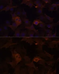 Anti-Filamin B antibody used in Immunocytochemistry/ Immunofluorescence (ICC/IF). GTX64428