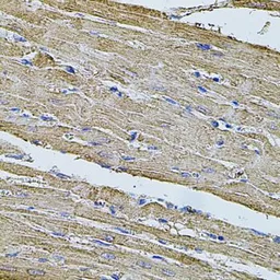 Anti-Filamin B antibody used in IHC (Paraffin sections) (IHC-P). GTX64428