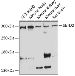 Anti-HYPB/SETD2 antibody used in Western Blot (WB). GTX64431