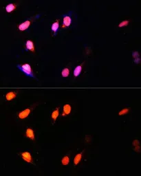 Anti-HYPB/SETD2 antibody used in Immunocytochemistry/ Immunofluorescence (ICC/IF). GTX64431