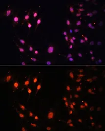 Anti-HYPB/SETD2 antibody used in Immunocytochemistry/ Immunofluorescence (ICC/IF). GTX64431