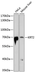 Anti-Cytokeratin 2 antibody used in Western Blot (WB). GTX64434