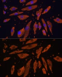 Anti-SIRP alpha antibody used in Immunocytochemistry/ Immunofluorescence (ICC/IF). GTX64435