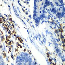 Anti-ASGPR1 antibody used in IHC (Paraffin sections) (IHC-P). GTX64440