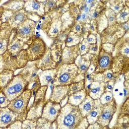 Anti-ASGPR1 antibody used in IHC (Paraffin sections) (IHC-P). GTX64440