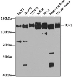 Anti-Topoisomerase I antibody used in Western Blot (WB). GTX64445
