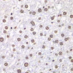 Anti-Topoisomerase I antibody used in IHC (Paraffin sections) (IHC-P). GTX64445