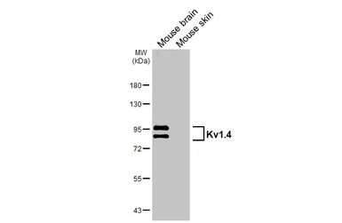 Anti-Kv1.4 antibody [GT240] used in Western Blot (WB). GTX644459
