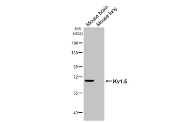 Anti-Kv1.5 antibody [GT241] used in Western Blot (WB). GTX644460