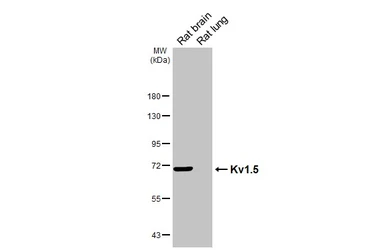Anti-Kv1.5 antibody [GT241] used in Western Blot (WB). GTX644460