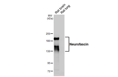 Anti-Neurofascin antibody [GT242] used in Western Blot (WB). GTX644461