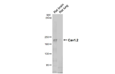 Anti-Cav1.2 antibody [GT243] used in Western Blot (WB). GTX644462