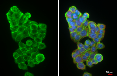 Anti-LRRK1 antibody [HL4600] used in Immunocytochemistry/ Immunofluorescence (ICC/IF). GTX644464