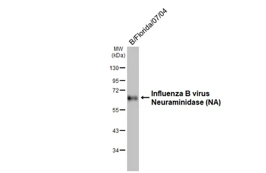 Anti-Influenza B virus Neuraminidase (NA) antibody [HL4607] used in Western Blot (WB). GTX644471