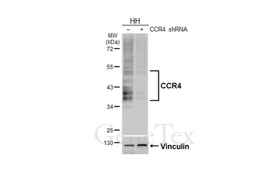 Anti-CCR4 antibody [HL4612] used in Western Blot (WB). GTX644476