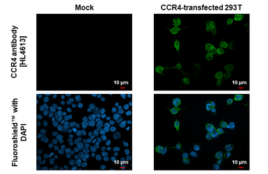 Anti-CCR4 antibody [HL4612] used in Immunocytochemistry/ Immunofluorescence (ICC/IF). GTX644476