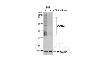 Anti-CCR4 antibody [HL4612] used in Western Blot (WB). GTX644476