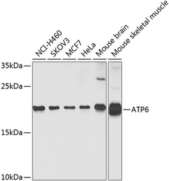 Anti-ATP6 antibody used in Western Blot (WB). GTX64448