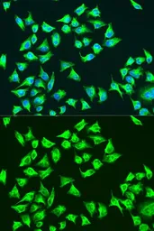 Anti-ATP6 antibody used in Immunocytochemistry/ Immunofluorescence (ICC/IF). GTX64448