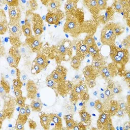 Anti-GABARAP antibody used in IHC (Paraffin sections) (IHC-P). GTX64449