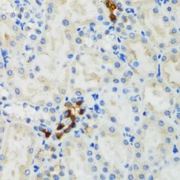 Anti-GABARAP antibody used in IHC (Paraffin sections) (IHC-P). GTX64449